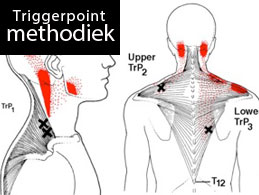 triggerpoint therapie eindhoven